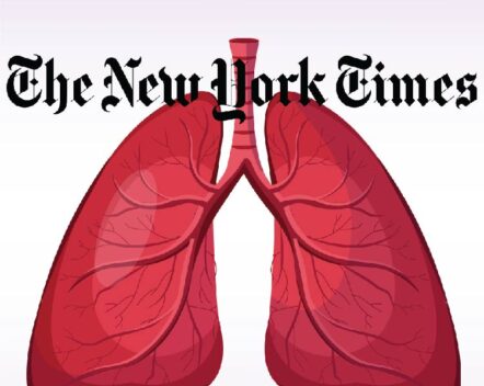 In astounding test, scientists revive damaged lungs for transplant