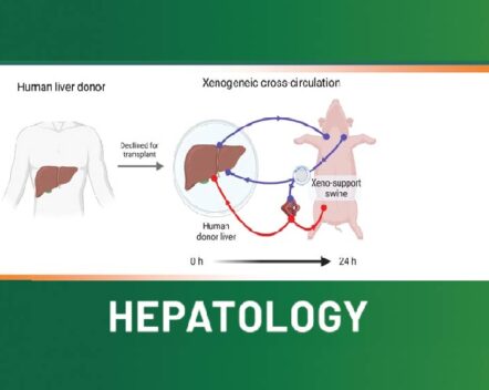 Xenogeneic cross-circulation for physiologic support and recovery of ex vivo human livers