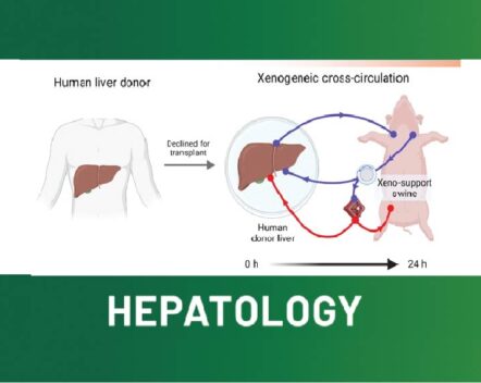 Xenogeneic cross-circulation for physiologic support and recovery of ex vivo human livers